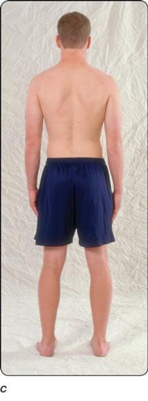 Figure 4.2 Correct standing alignment: anterior, lateral, and posterior views.