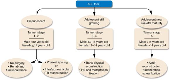 Figure 15.3 Surgical decision making for anterior cruciate ligament injuries in skeletally immature patients.