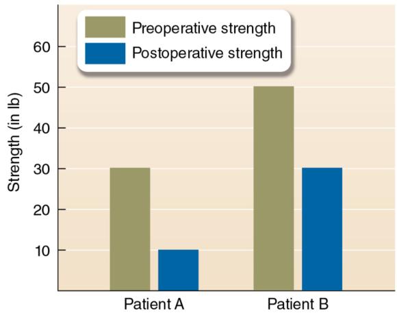 Figure 1.3 Example of differences in preoperative and postoperative strength measures between two similar patients. The stronger a patient is before surgery, the stronger a patient is after surgery.