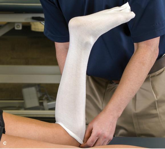 Figure 2.32 Posterior splinting procedure applied to immobilize the foot and ankle. Position the foot and ankle in the functional position, which is 0° of dorsiflexion. Measure 4 inches (10 cm) beyond the base of the popliteal fossa and 4 inches (10 cm) beyond the metatarsal heads to determine the amount of stockinette needed. Apply the stockinette. Beginning at the metatarsal heads, roll the cast padding circumferentially from distal to proximal ending at the base of the popliteal fossa. Measure from the base of the popliteal fossa to the metatarsal heads to determine the length of the splint. Starting at the metatarsal heads, position the posterior splint against the plantar surface of the foot and posterior aspect of the leg. Fold down any excess splint material at the knee. Fold the stockinette and cast padding over the ends of the fiberglass splint. Starting distally, secure the splint in place with an elastic wrap. () Completed posterior splint.