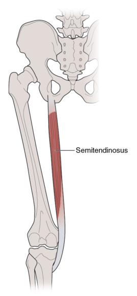 Semitendinosus