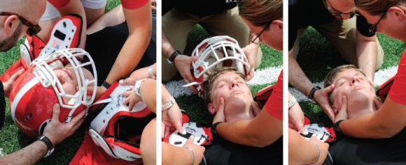 Figure 9.25 Helmet removal with face mask.